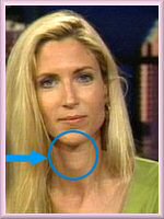 coulter